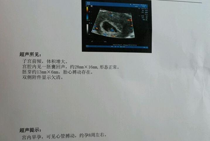孕早期见红医生让保胎,孕前期见红去了医院问什么