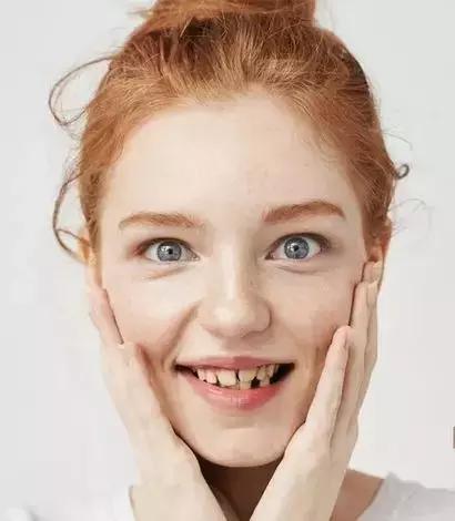 一种“隐形”治疗子宫肌瘤的方法!