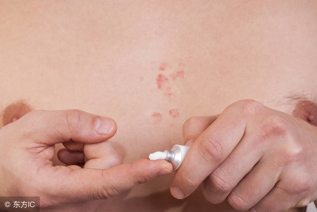 湿疹对生理器官有影响吗,湿疹对婴儿有什么影响
