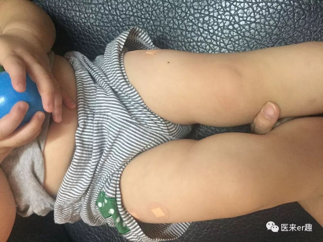 香港打新冠疫苗在哪里预约,香港打9价hpv疫苗怎么预约