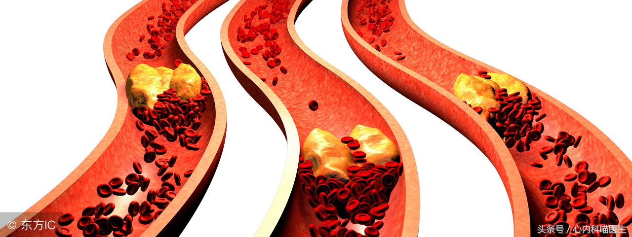 有什么除心脑血管血栓的药物,心脑血栓的防治方法