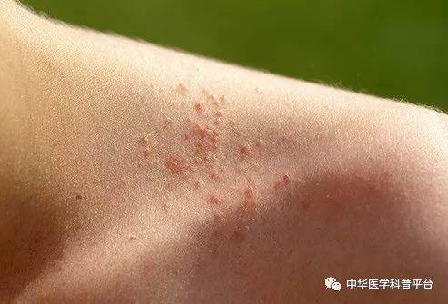 炎热的天气对身体伤害大吗,炎热的天气带来了什么危害