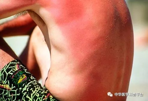 炎热的天气对身体伤害大吗,炎热的天气带来了什么危害