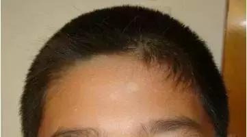 娃儿身上长“可可”该挂哪个科，妈老汉儿遇到这种情况最容易打蒙！