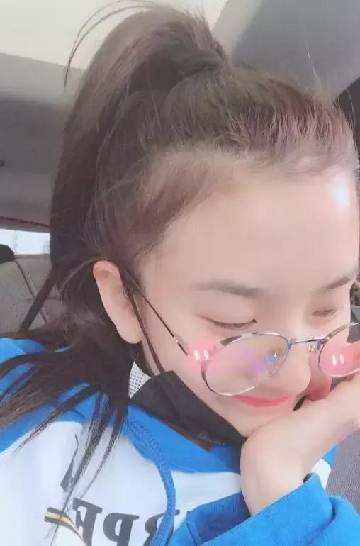 杨幂全脸脂肪填充图片,杨幂胎毛发际线教程