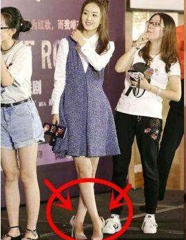 明星不为人知的小缺陷,明星不为人知的缺陷