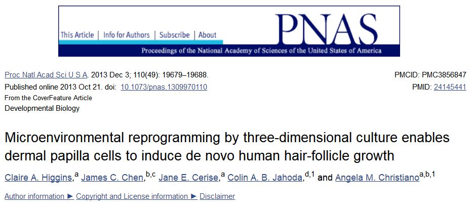 治疗脱发无需植发,脂溢性脱发最新医学研究