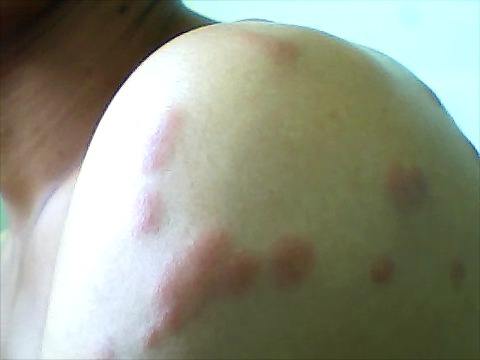 世界上的吸血虫子有几种,昆虫界的常见吸血鬼