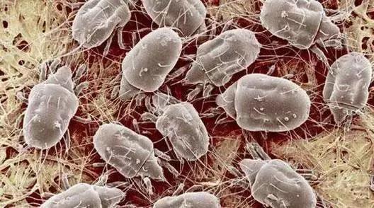 脱发挠头皮,挠头皮脱发怎么办