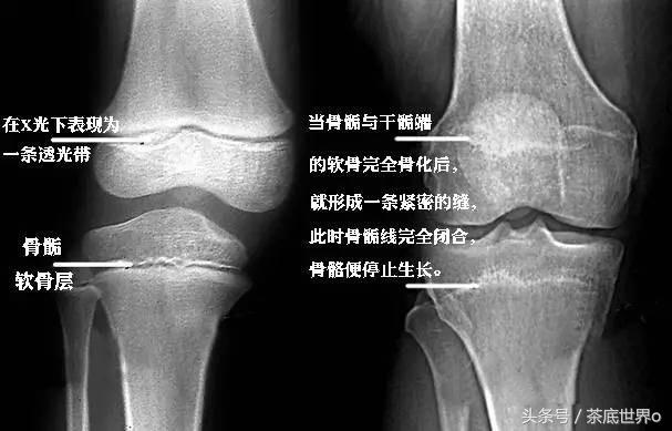 男生长高的征兆和方法,男生长高的几个前兆