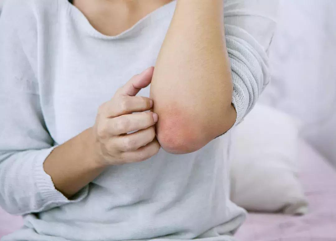 芦荟外敷内服效果怎么样,芦荟外敷内服有什么作用