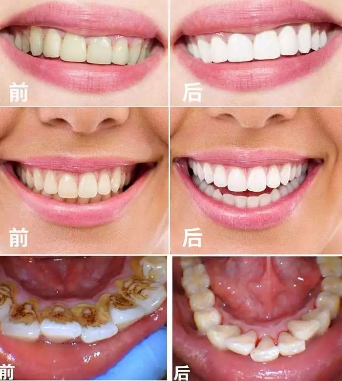 抖音卖爆电动牙刷,卖爆了的牙刷