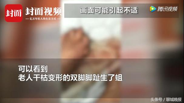 敬老院老人脚烂生蛆！院方：老人生病很正常，我们护理得相当好