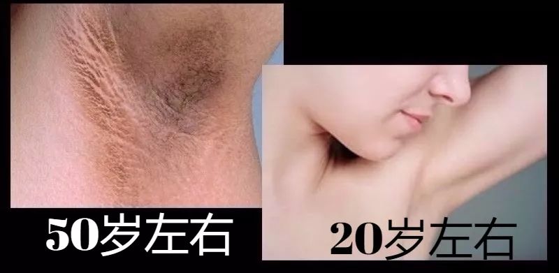 女生最需要保养的部位,适合女性的保养部位