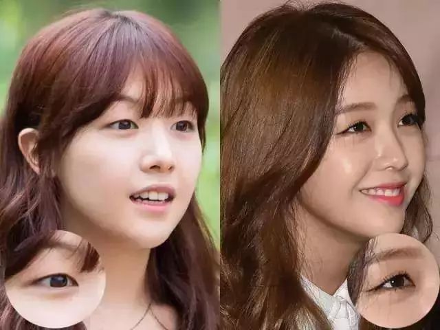 睫毛进入疯长期,睫毛什么时候会疯长