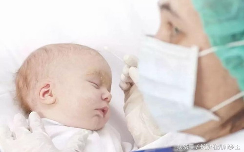 宝宝身上湿疹反复发作是怎么回事,肛周湿疹老反复怎样才能彻底治愈