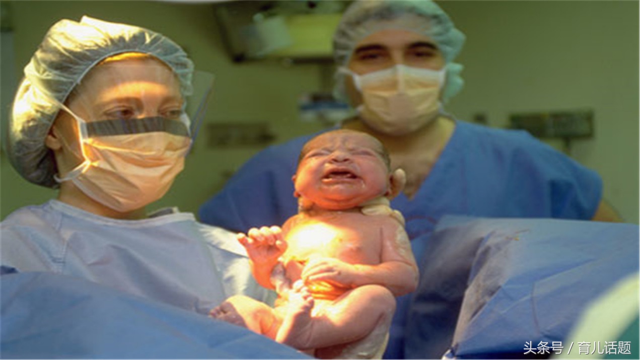 如何避免胎宝宝长胎记,新生儿你不知道的八件事