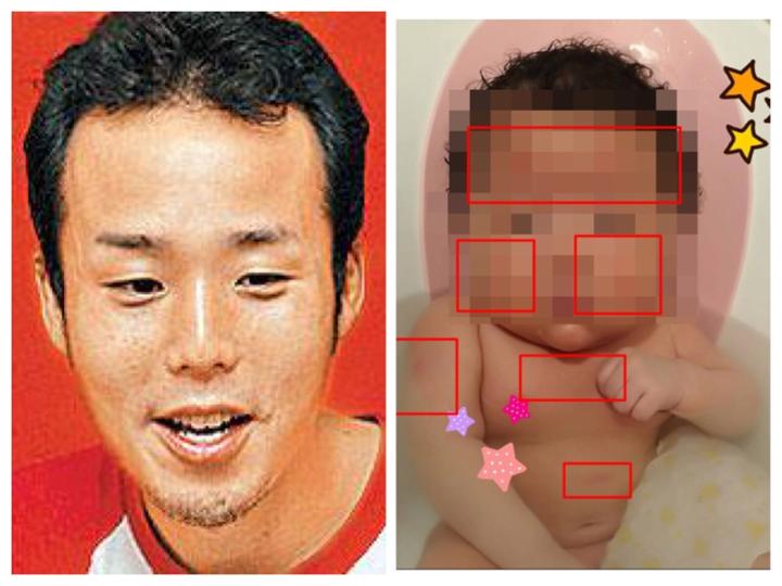 日男星3个月女儿疑受虐，摔3次头肿全身红块，仍未脱离危险