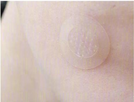 控油祛痘神器推荐,祛痘神器国货推荐