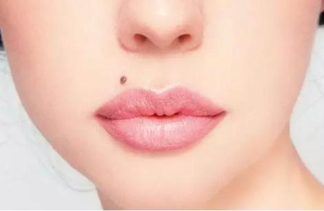 小女孩脸上的痣什么时候去掉好,脸上痣掉了留下的红疤怎么去掉