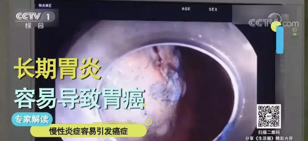 各种癌症预防方法,得了癌症最怕的10种方法