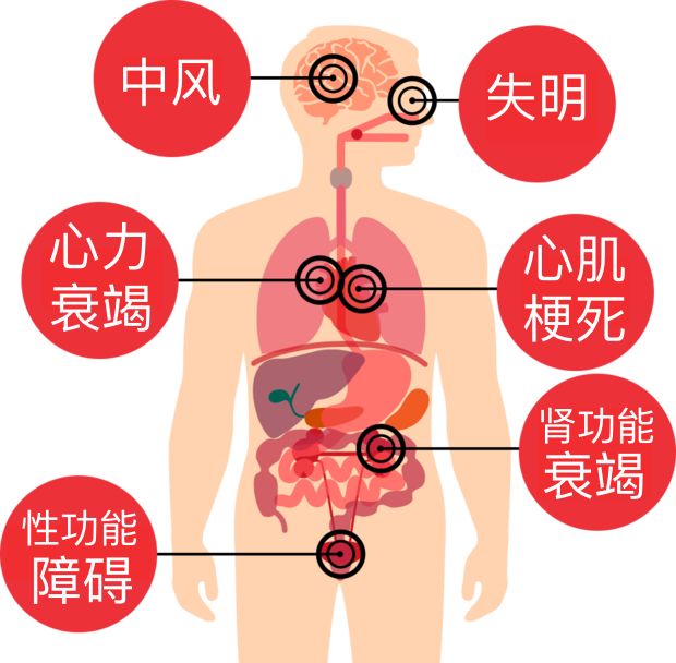 高血压怎么样才能发生猝死,高血压隐形杀手