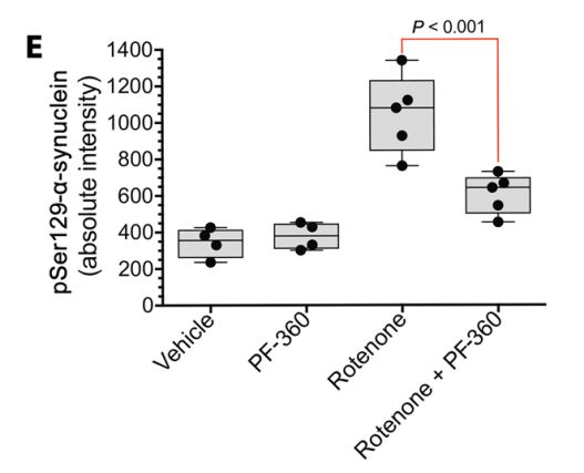 《科学》子刊:科学家首次证实正常的LRRK2基因也会促进帕金森病,90%发病原因不明的患者或许也有救了|科学大发现