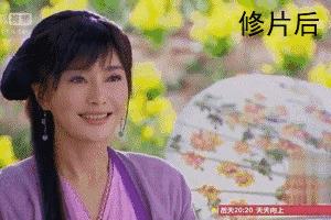 秦岚霸气回应打瘦脸针是为了上镜,秦岚谈瘦脸针