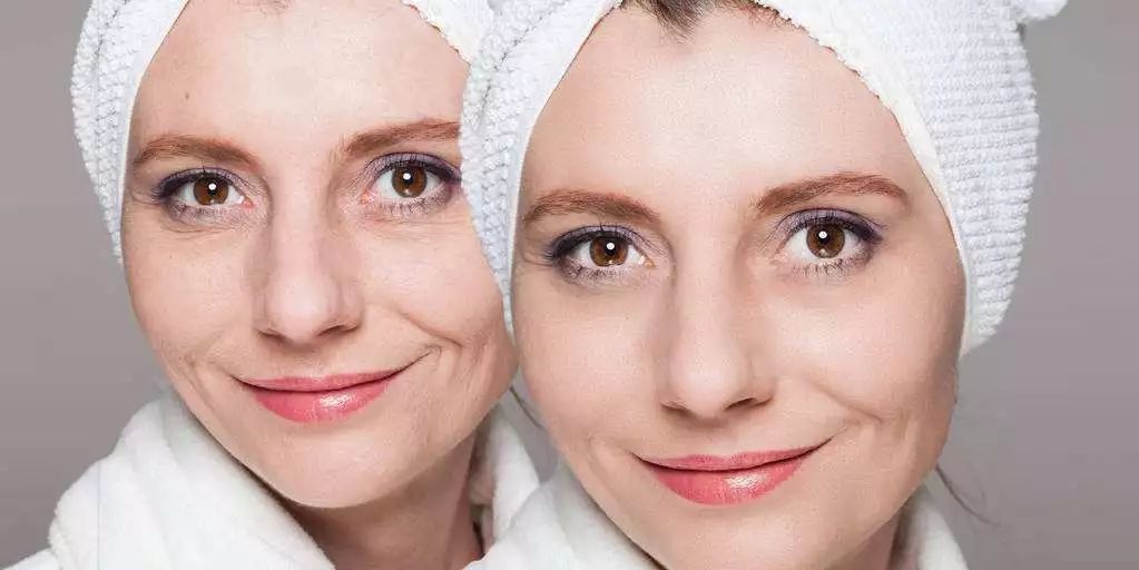 去黑头的10个小妙招,5种快速去黑头的小妙招