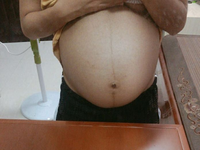 顺产小王子一枚,总结了我的孕期反应和生产过程,好孕传给大家