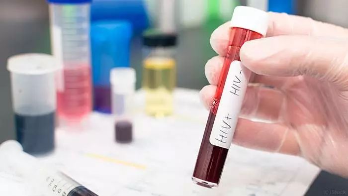 石家庄市艾滋四代检测,石家庄疾控中心艾滋病检测流程