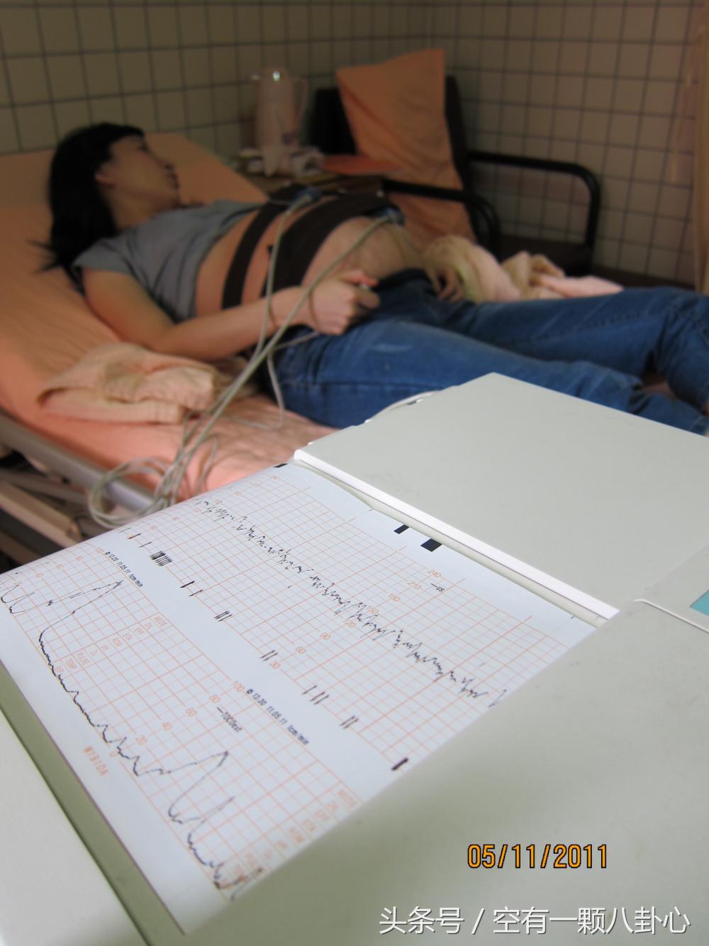 产前选项有什么重要性,产前好还是产后好