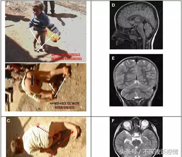 “*亲近**繁衍”会怎样？土耳其这家人来告诉你