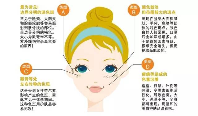 如何判断斑类型,看图识斑看看你究竟是什么斑