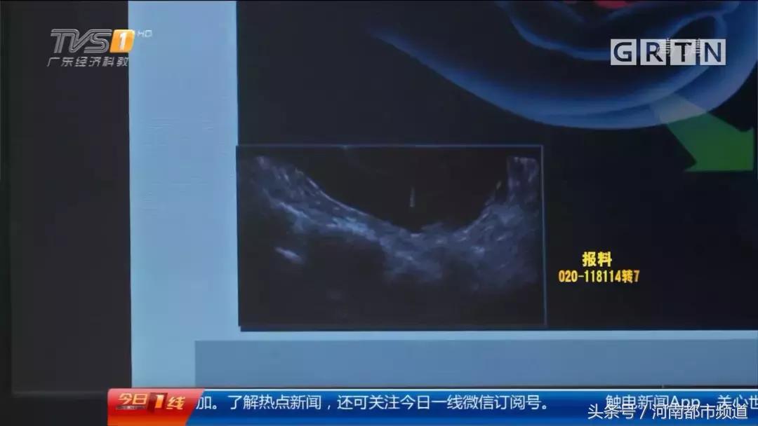 灏忓コ瀛╄缃戝弸甯﹁蛋鍚庣画,鏈垚骞村コ瀛╄缃戝弸甯﹁蛋