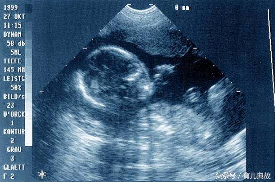 孕妇6个多月吃饭没有胃口怎么办,怀孕五个月了没胃口吃东西怎么办