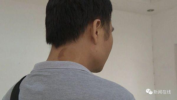 广西一社区医生被指侵犯病人：按摩胸部并言语挑逗