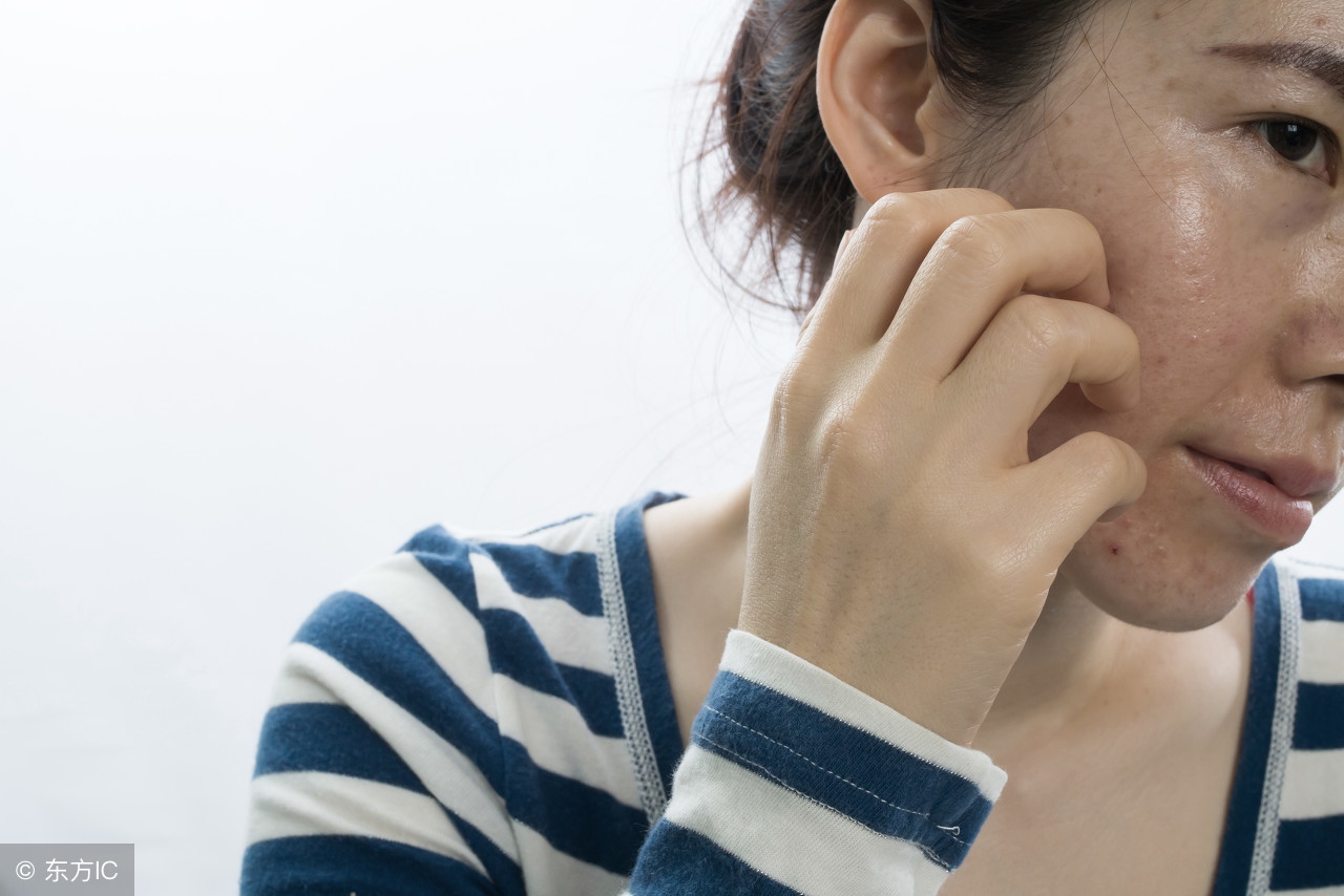 脸上起了大量的褐斑怎么治疗,脸上长褐斑是因为什么原因引起的