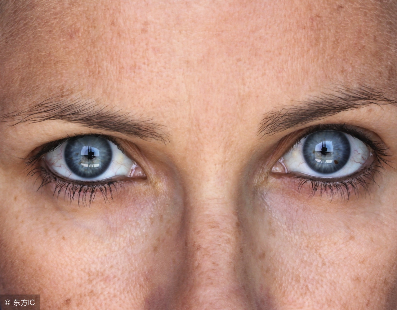 脸上起了大量的褐斑怎么治疗,脸上长褐斑是因为什么原因引起的