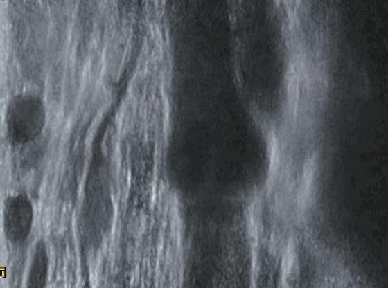 跷二郎腿有什么危害腿粗,跷二郎腿有什么危害图片