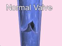 跷二郎腿有什么危害腿粗,跷二郎腿有什么危害图片