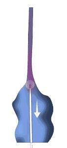 跷二郎腿有什么危害腿粗,跷二郎腿有什么危害图片