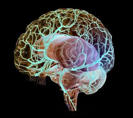 脑血管畸形该如何预防,脑血管畸形患者怎样预防脑梗