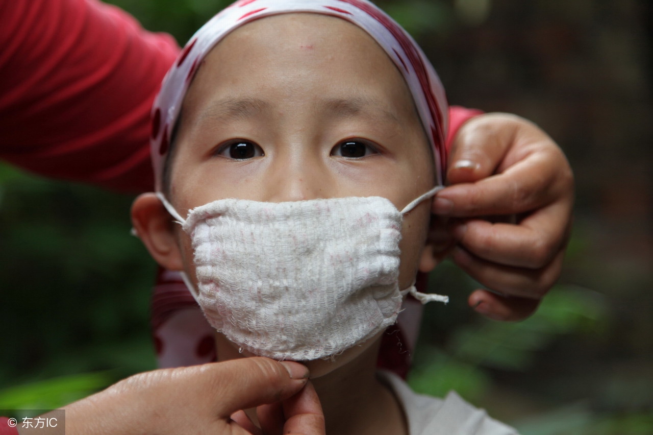 海上名医慢粒白血病治疗,早期白血病怎么治疗比较好