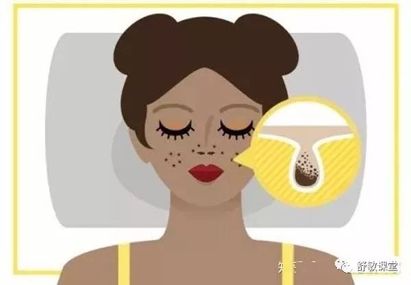 油性敏感肌特点,如何判断是不是油性敏感肌