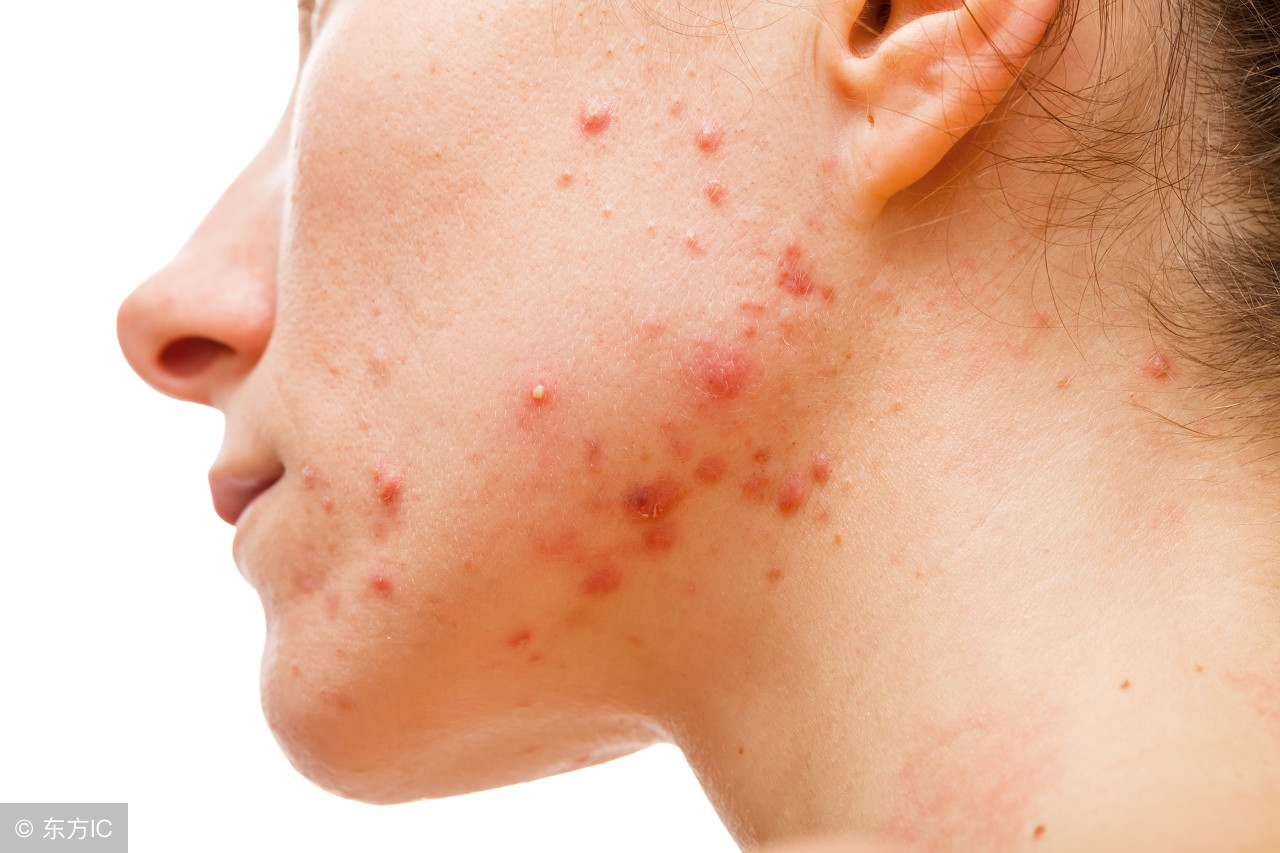 全身频繁长疮是怎么回事,身上多处长疮是什么症状