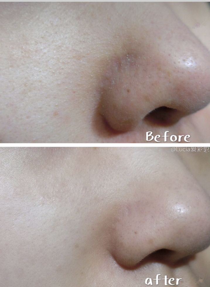 luna洁面仪最新款,亲测好用四款洁面