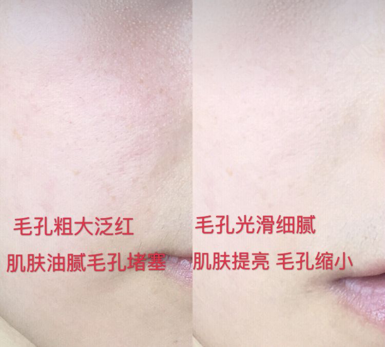 luna洁面仪最新款,亲测好用四款洁面