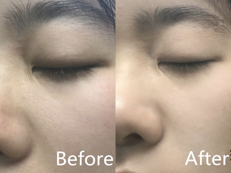 luna洁面仪最新款,亲测好用四款洁面