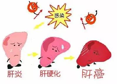 肝炎怕喝水,肝炎最怕两种水